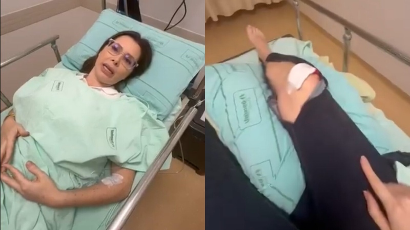  Carol de Toni é atacada por cachorro e passa por cirurgia