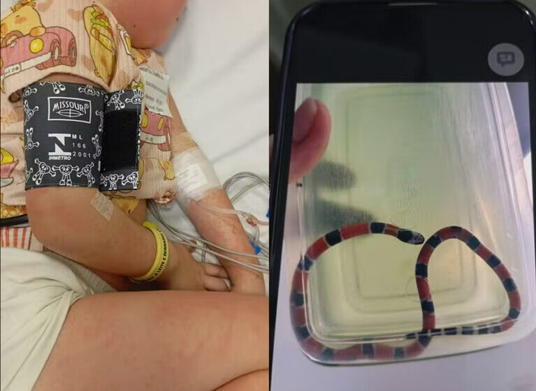 Menina de 4 anos sofre choque anafilático após irmão confundir cobra-coral com minhoca em SC